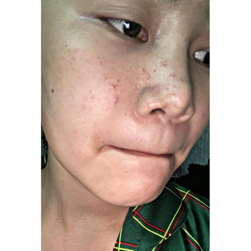 [HCM]DR MAI MỤN CHÍNH HÃNG