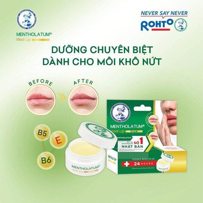Sáp dưỡng môi rohto chuyên biệt cho môi khô nứt nẻ 7g