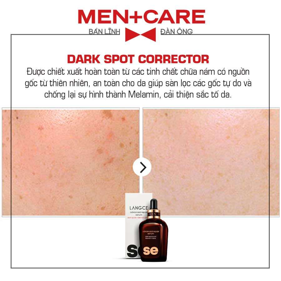 LANGCE SErum THÂM NÁM, SẠM DA, TÀN NHANG, ĐỒI MỒI 30ml cho Nam