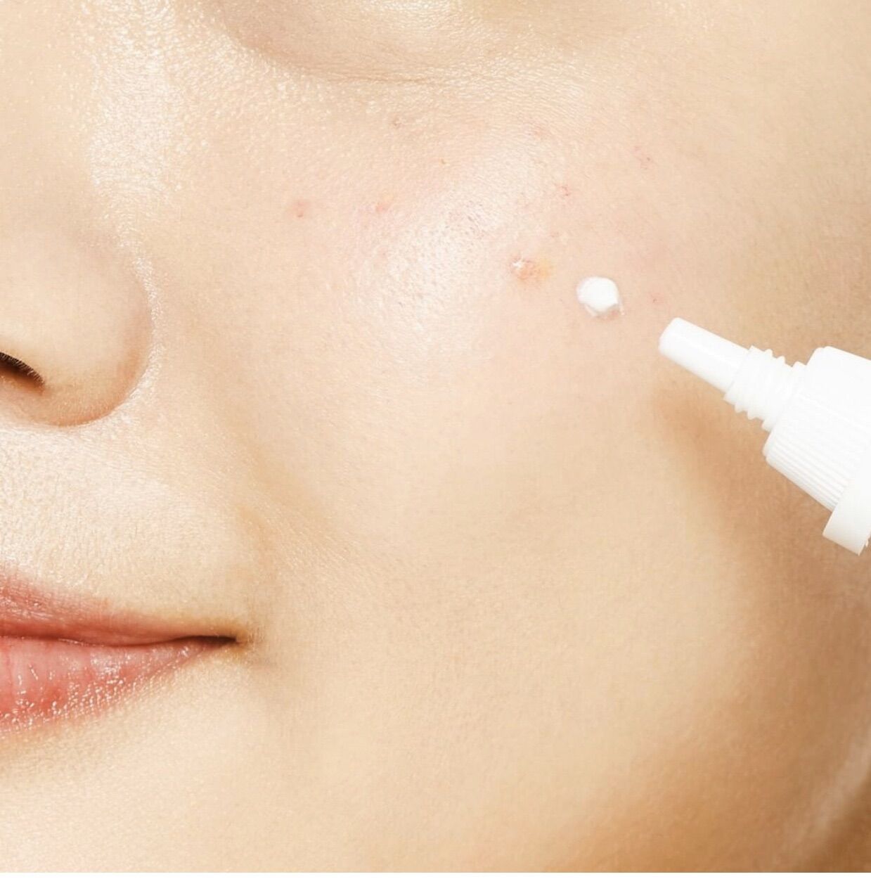 🌟Kem dưỡng da Mụn Cosrx AC Collection Ultimate Spot Cream