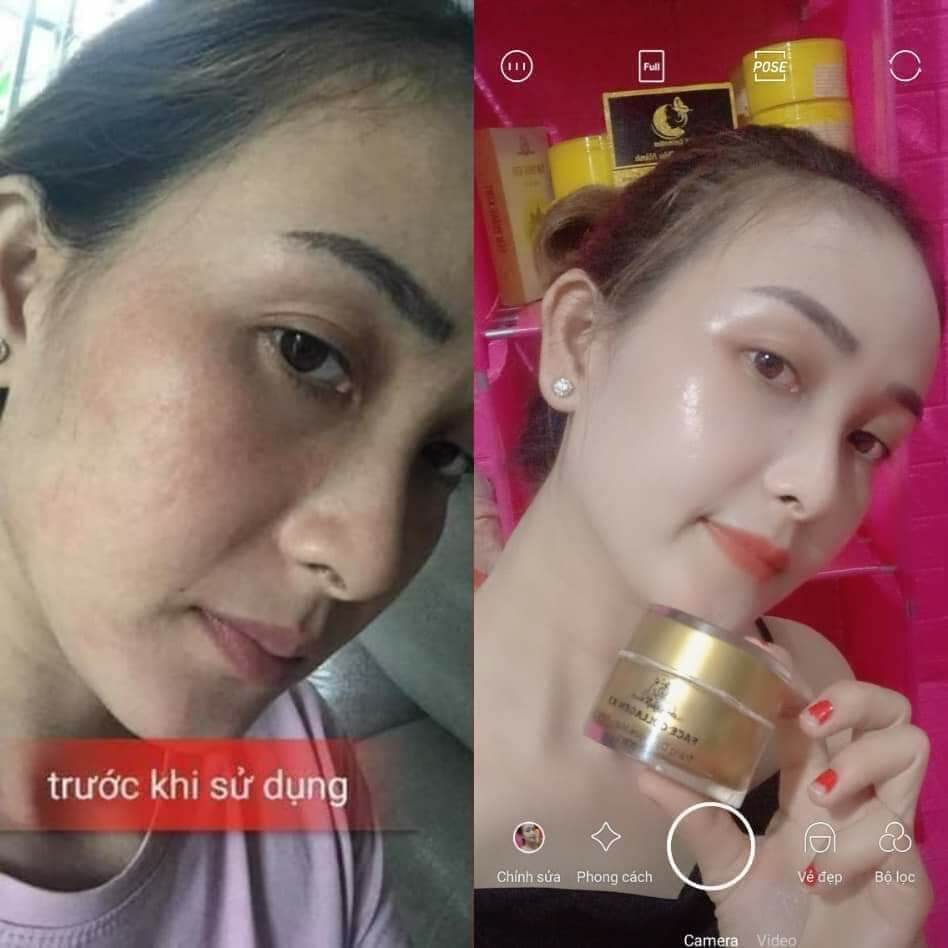 [Hcm]Kem Face Collagen X3 Đông Anh Hàng Chính Hãng Có Team Cào