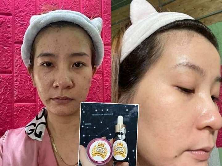 kem face Ngọc Oanh
