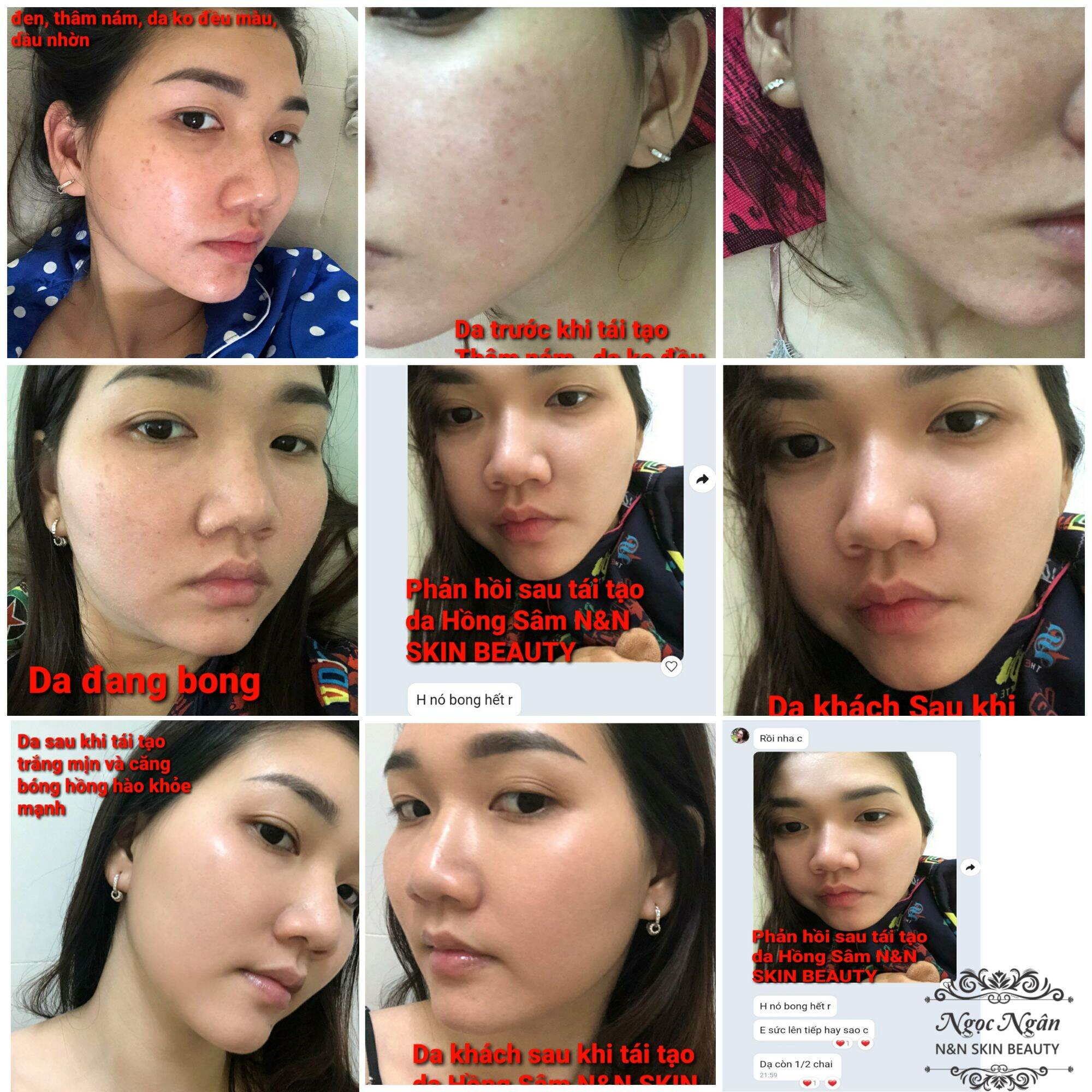 Combo Tái Tạo Hồng Sâm ( tinh chất hồng sâm + bột thảo dược rửa mặt)