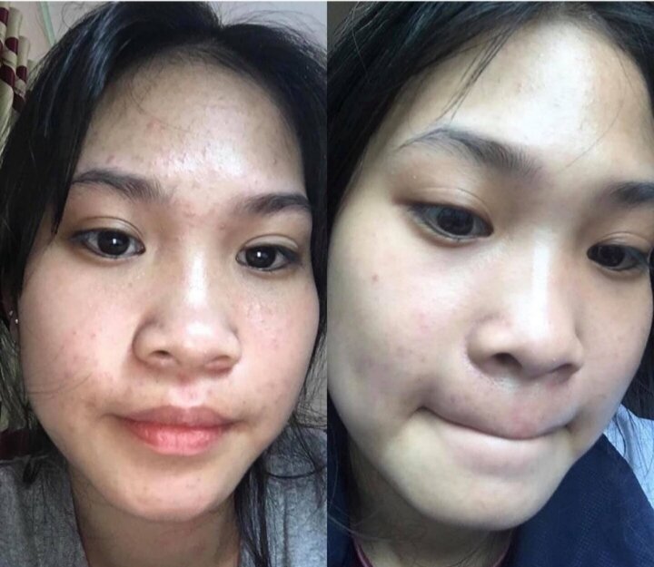 Bột Thảo Dược Chăm sóc da cao cấp - Thảo Dược Khang