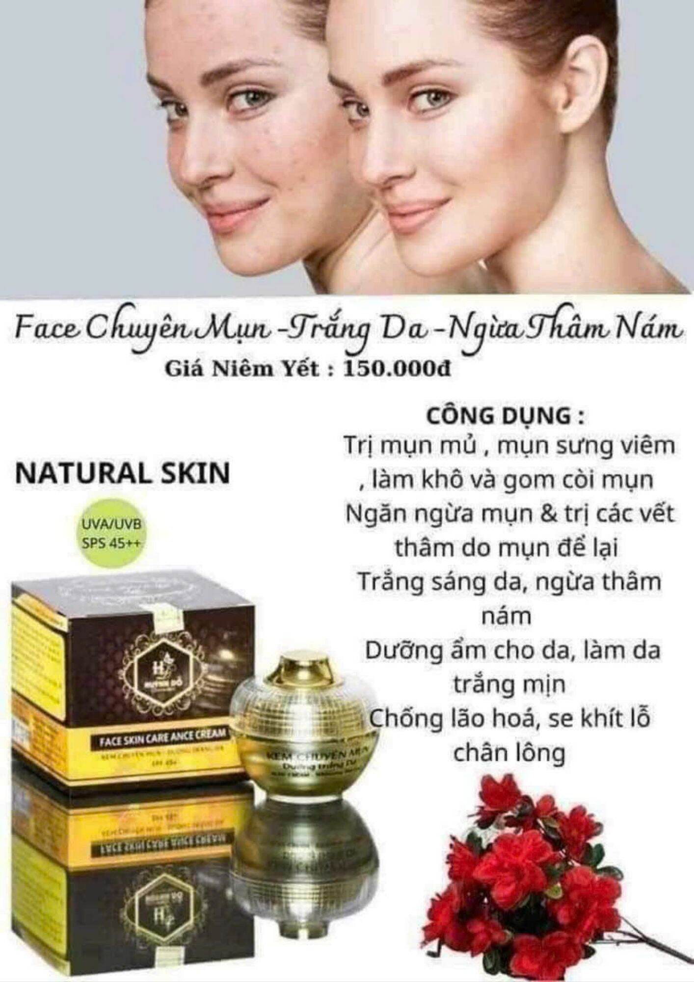 Kem Face Chuyên Mụn và Trắng Da Huỳnh Đỗ