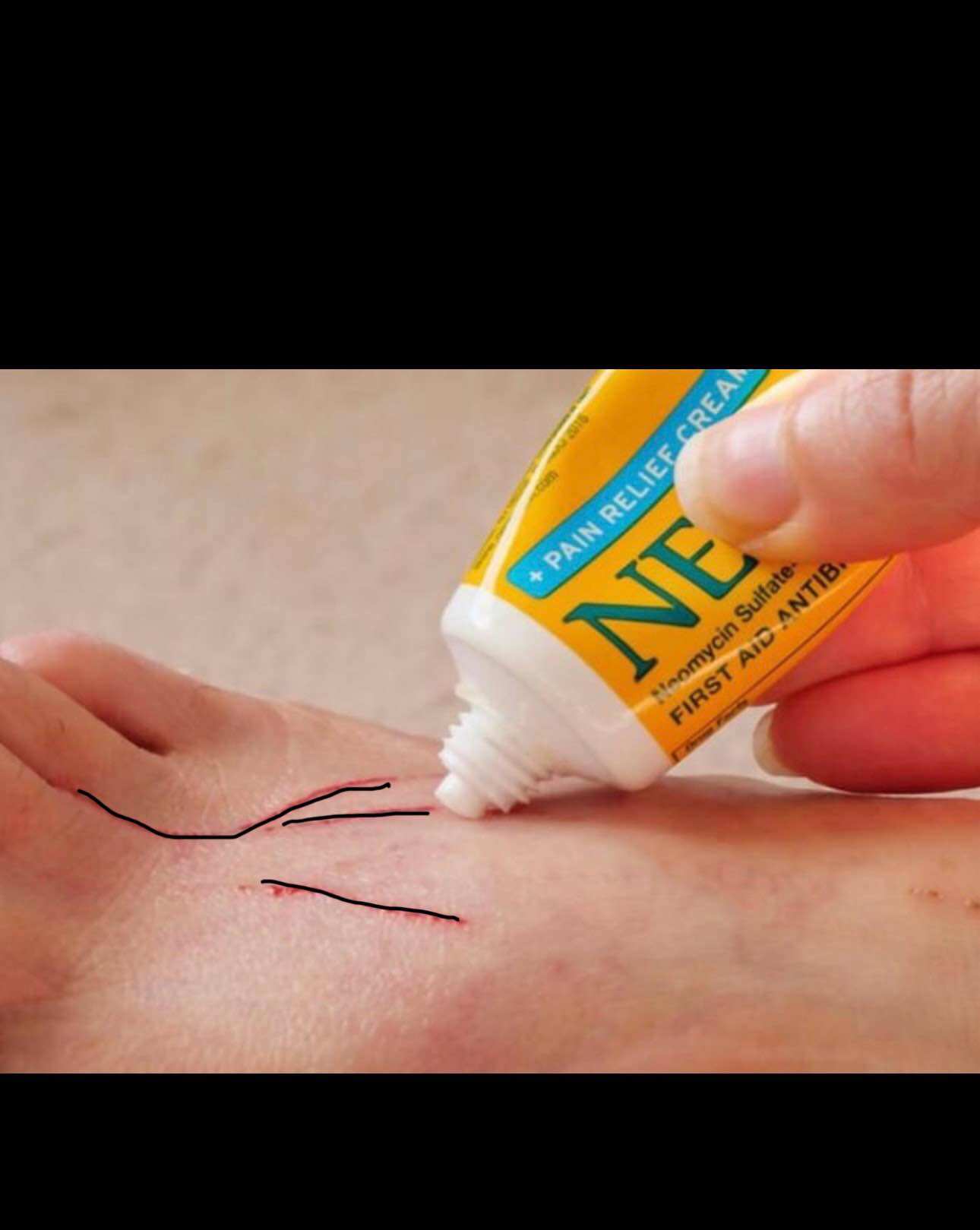 Kem sức Neosporin Original Ointment (1 hộp gồm 3 tuýp)