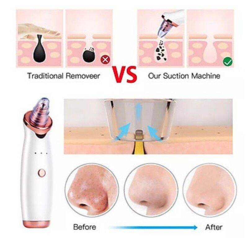 [Tặng 5 đầu hút] Máy Hút Mụn mini cầm tay