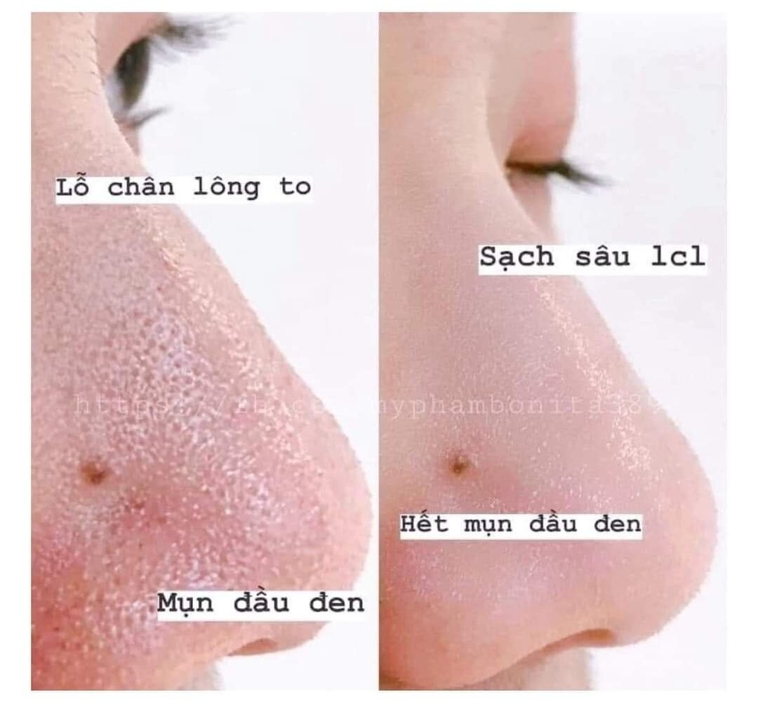Mặt nạ đất sét Kihls 14ml