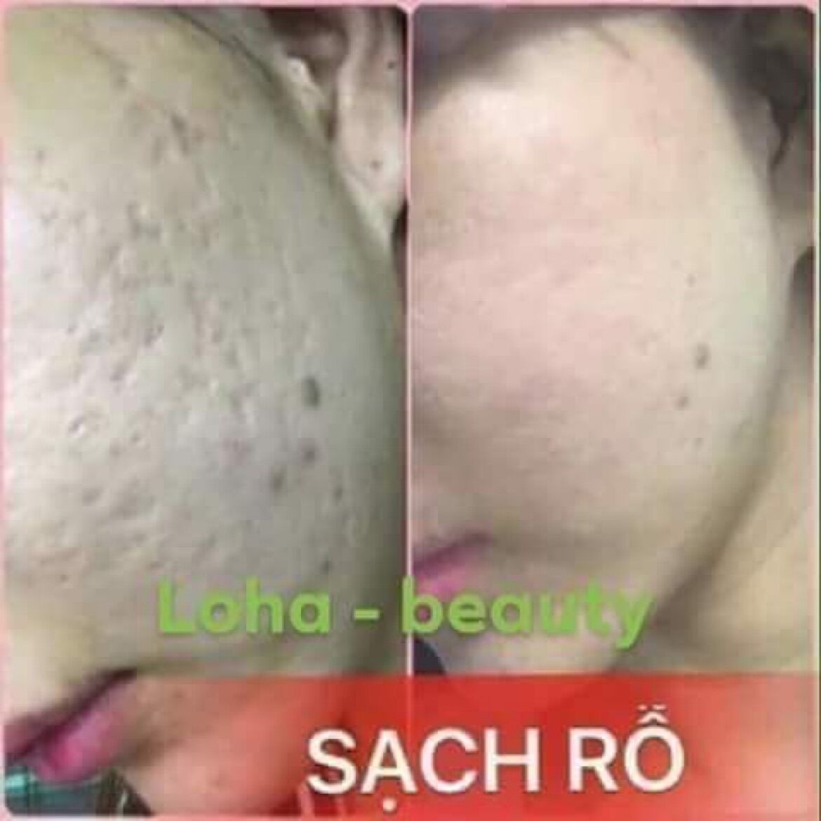 Tinh chất tái tạo loha 50ml (tặng tonner)