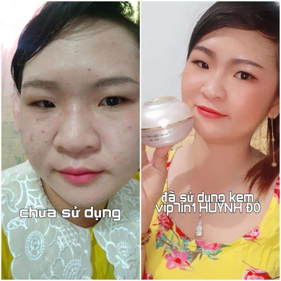 [TẶNG KÈM SERUM VÀNG 24K+ MẶT NẠ] Kem face vip 7 in 1 Huỳnh Đỗ