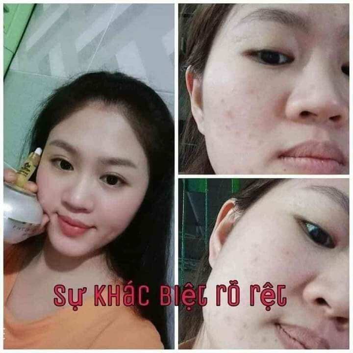 [TẶNG KÈM SERUM VÀNG 24K+ MẶT NẠ] Kem face vip 7 in 1 Huỳnh Đỗ