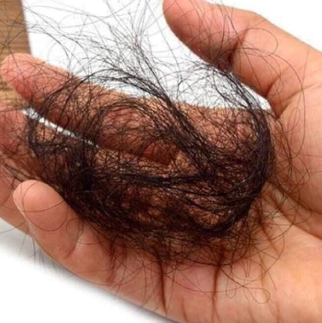 Dầu gội kích thích mọc tóc Hairloss thái lan