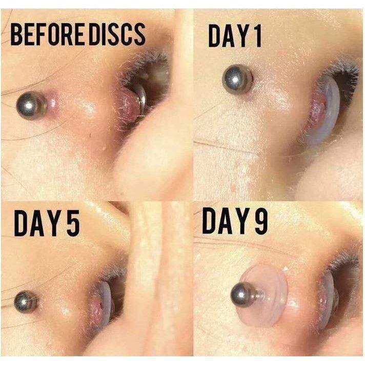 MIẾNG NẸP BUMP - Miếng Nopull Disc (7mm/9mm) - Đệm siết (3mm) - Miếng nẹp bump tai, mũi, rốn, môi, lưỡi,...