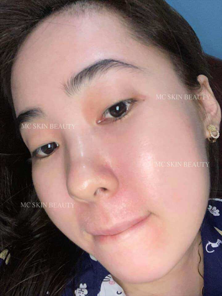 COMBO TÁI TẠO HỒNG SÂM MCSKIN