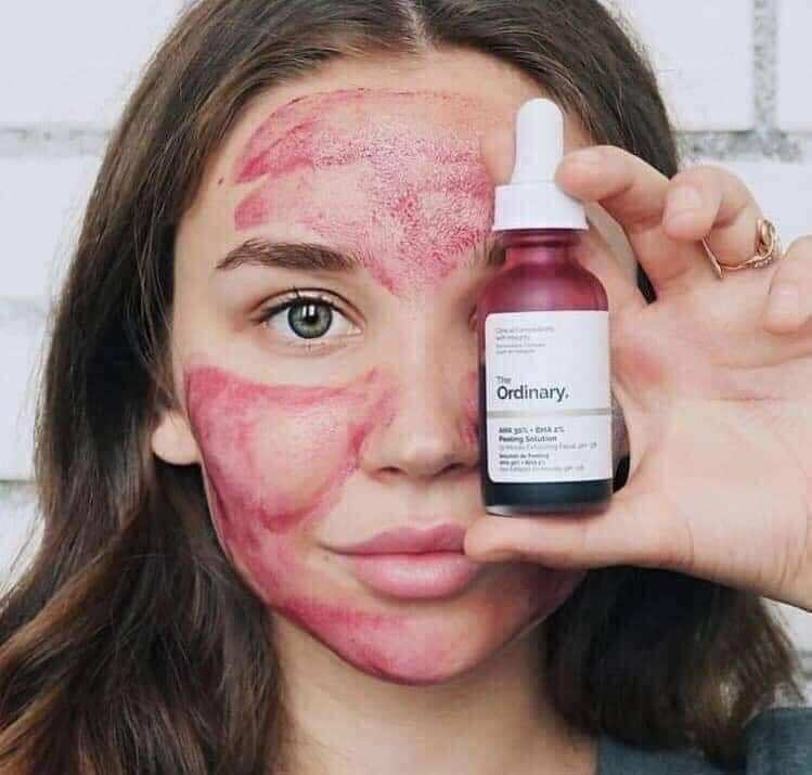 Peel đã The Ordinary AHA 30%-BHA  2%