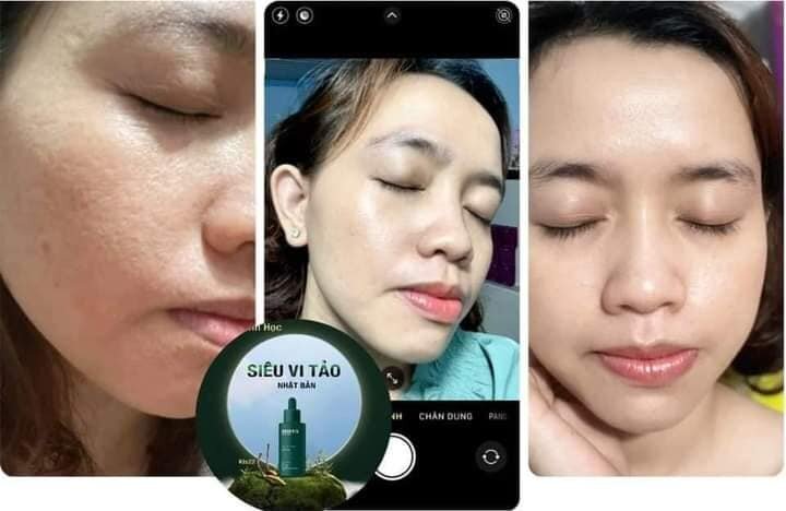 Combo Tái Sinh Da Green Vita (1 Serum và 1 Bột Rửa Mặt)