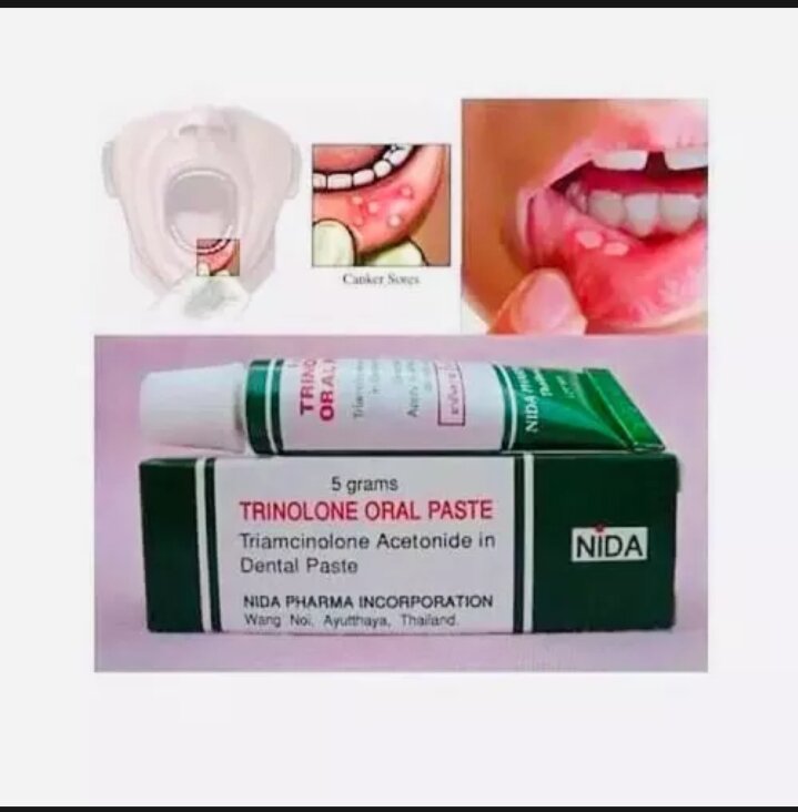 Kem bôi nhiệt miệng Trinolone Thái Lan