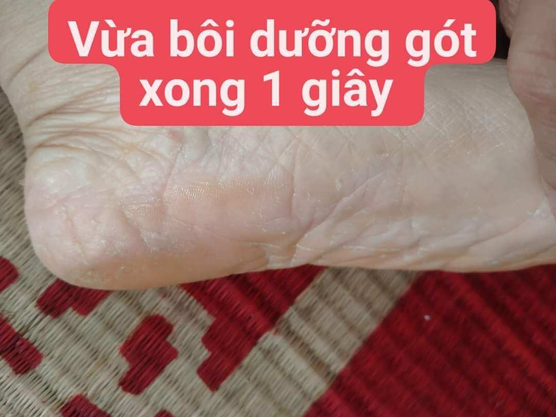 Kem Dưỡng ẩm  nứt gót da chân oriflame