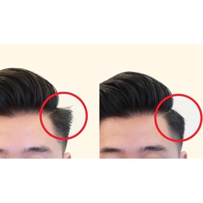 KEM ÉP SIDE TÓC NAM , KEM ÉP SIDE , ( Tặng Lược )