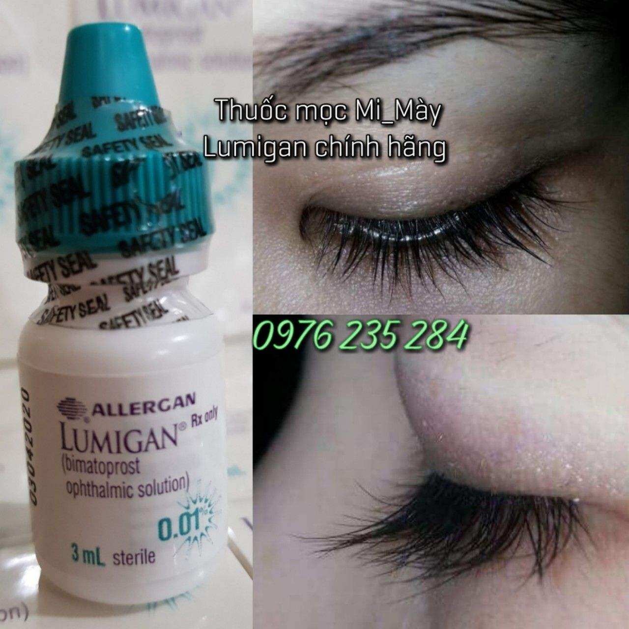 LUMIGAN MỌC LÔNG MÀY
