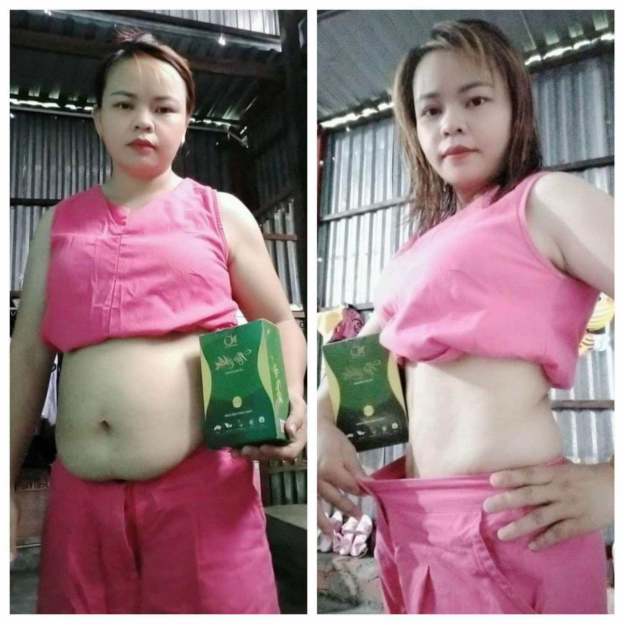 kẹo giảm cân NioSlim + quà tặng