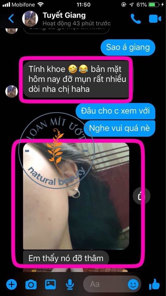 Mỡ Trăn Ngọc Lan Tây Nstore By Thanh Nhi triệt lông bikini, dưỡng da, chấm mụn,giảm thâm mụn