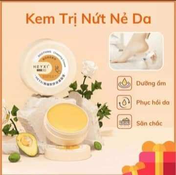 Kem nứt gót chân heyxi