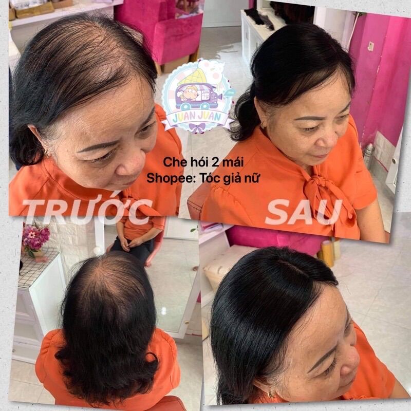 Tóc giả che hói che bạc của nữ ❇️