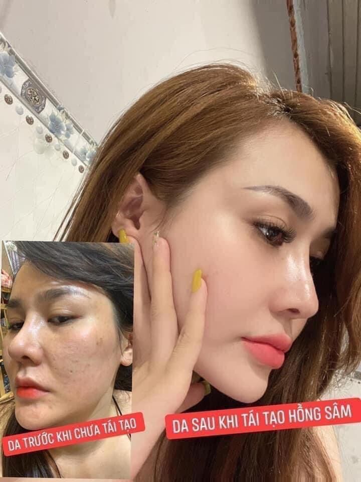 TÁI TẠO DA HỒNG SÂM + BỘT RỬA MẶT <HÀNG CHÍNH HÃNG CTY>