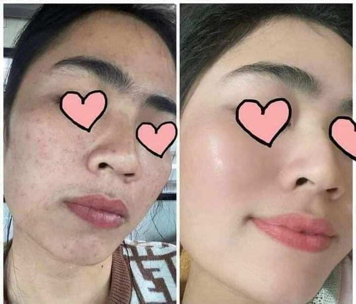 kem face men gạo nicos ( chính hãng)
