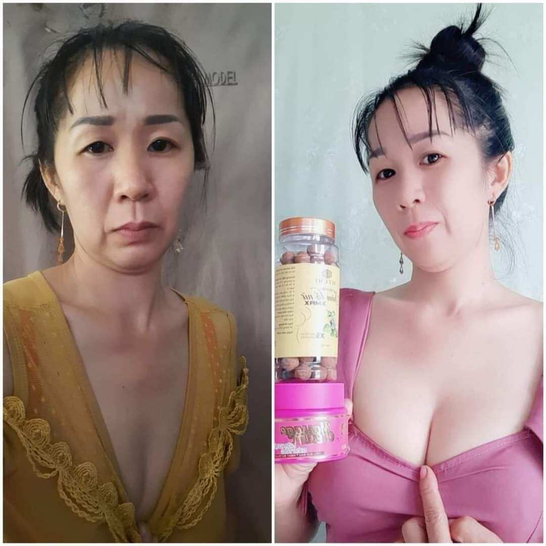 Kẹo mầm sâm tố nữ Xmax Mychi (mua 4 hộp tặng 1 hộp=5 hộp)