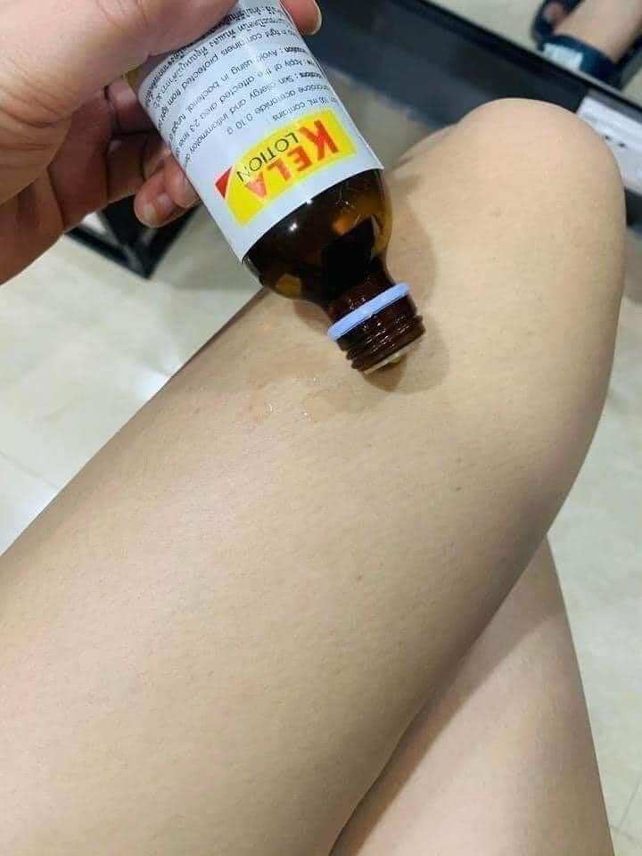 Kela Lotion Dành Cho Da Viêm Lỗ Chân Lông 60ML Thái Lan