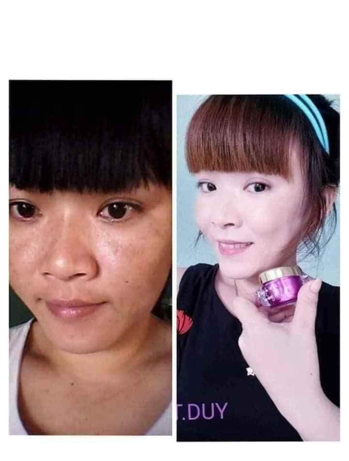 KEM FACE TÍM N COLLAGEN