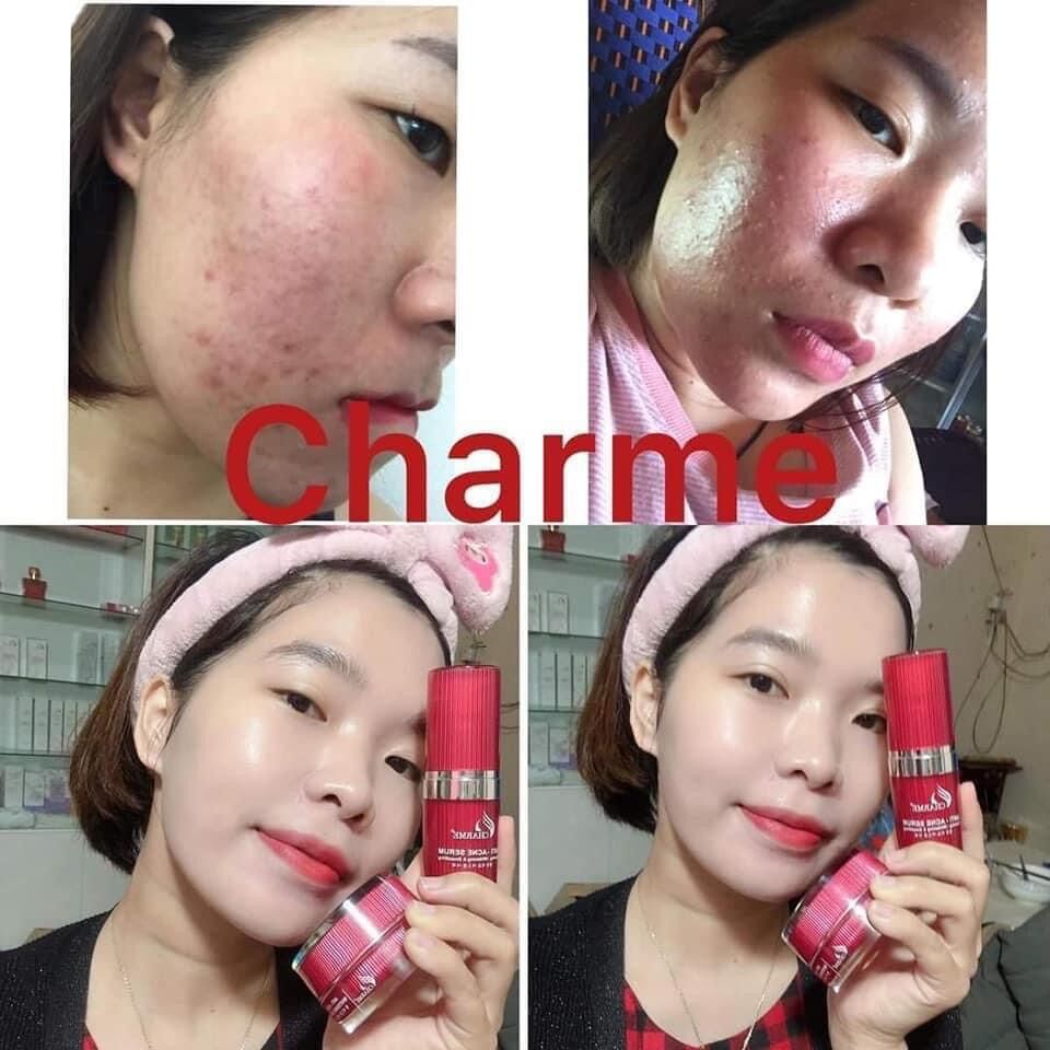 Combo Serum và Kem Thông Đỏ CHARME - Shi91 Cosmetics