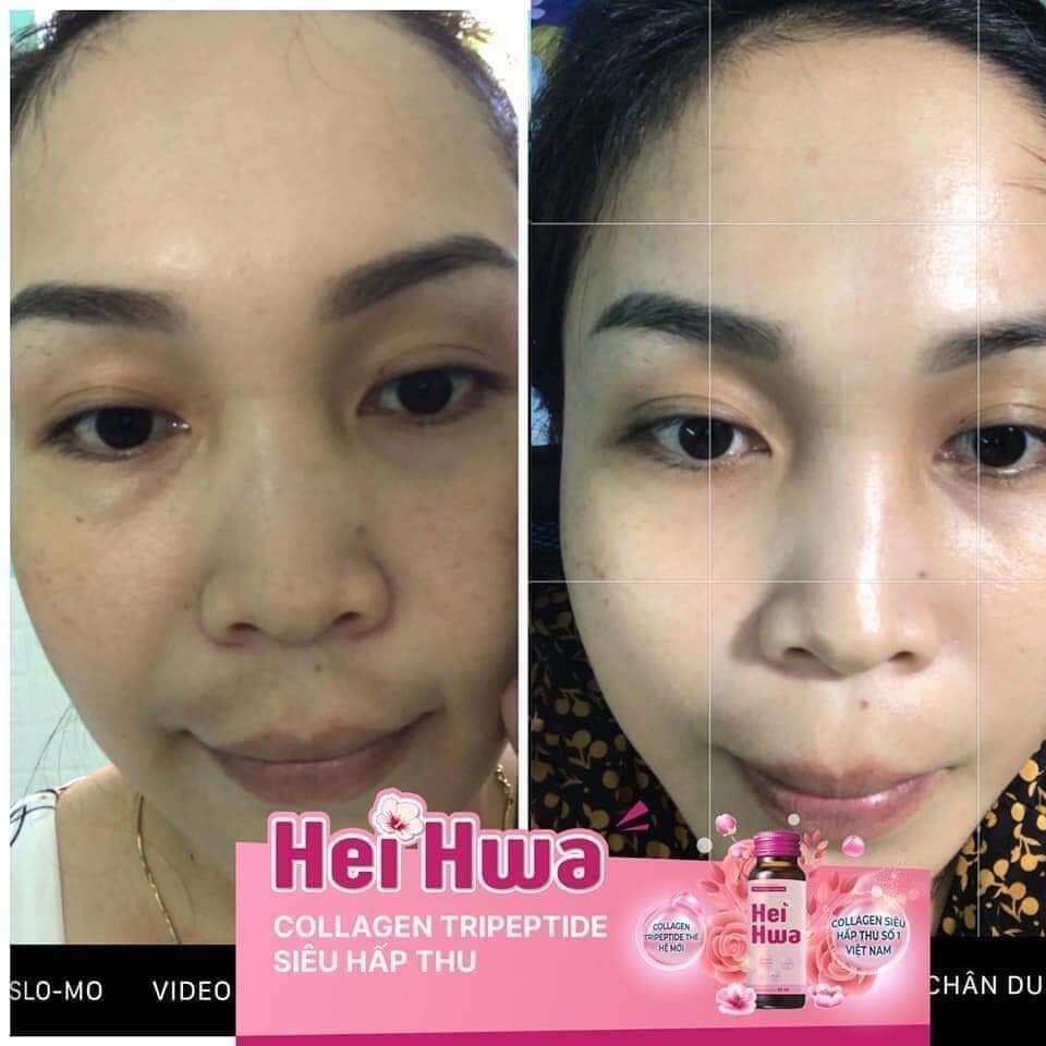 Collagen Tripeptide Hei Hwa siêu hấp thu ( Hộp 10 chai 30ml)