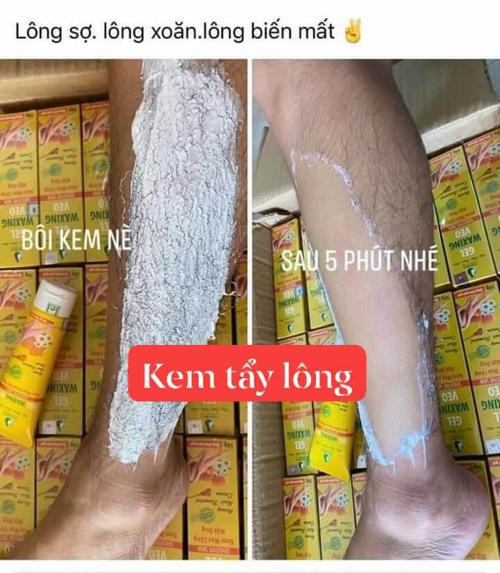 Kem Tẩy Lông Ngân Bình (K Đau K Rát...)