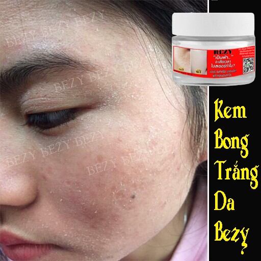 Kem Bong Da Tái Tạo Mờ Nám Sạm Bezy