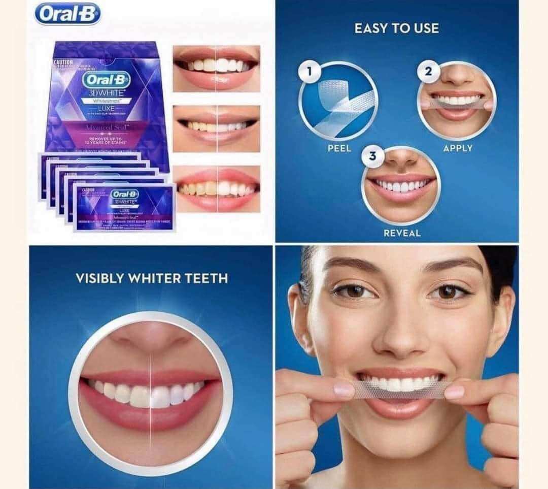 Miếng dán tẩy trắng răng OralB 3D White Whitestrips (1 hộp 14 miếng )