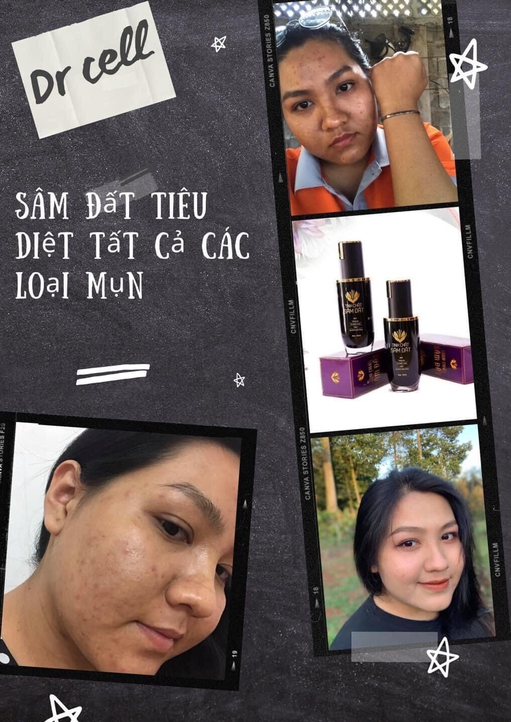 Tinh chất sâm đất