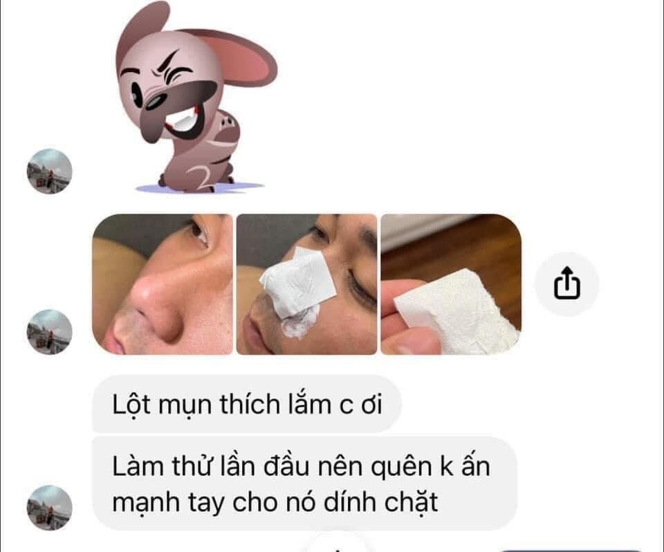 Gel lột mụn nha đam thái lan