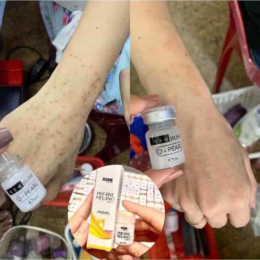 SERUM JIUHE THÂM THANH TÔ BYE BYE MELANO