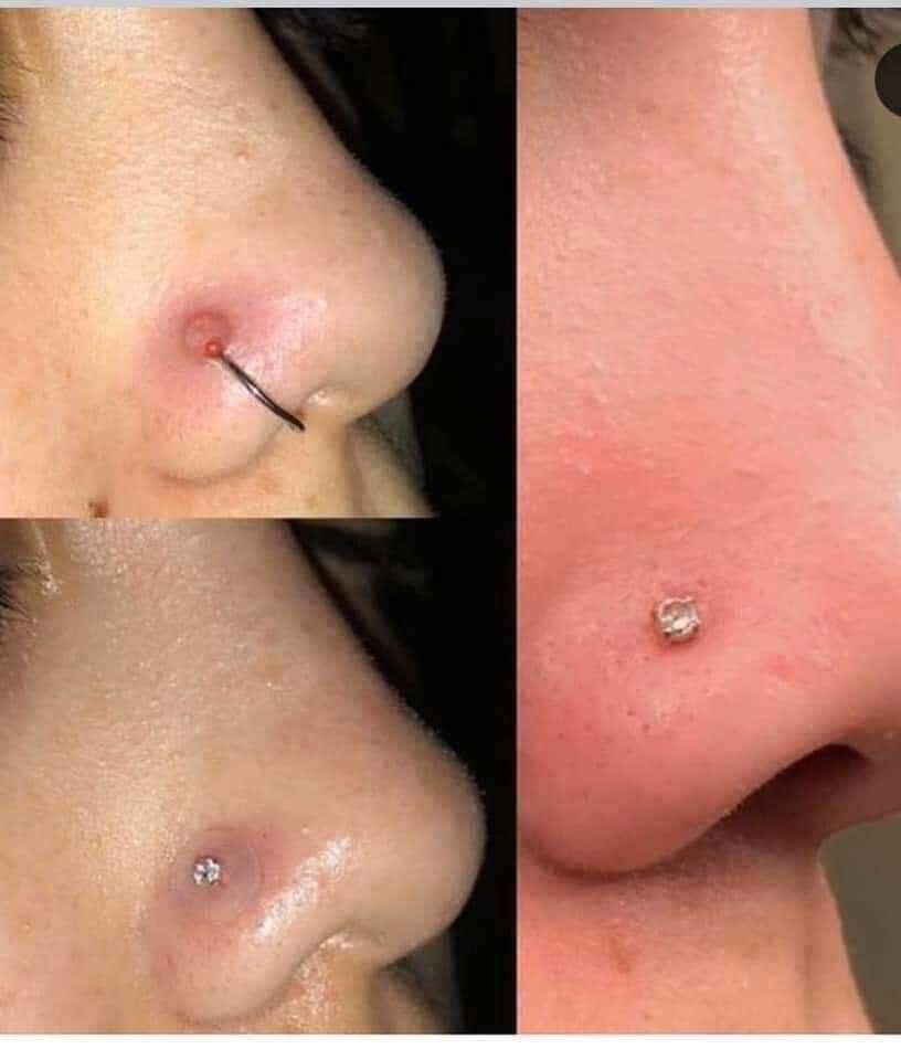 MIẾNG NẸP BUMP - Miếng Nopull Disc (7mm/9mm) - Đệm siết (3mm) - Miếng nẹp bump tai, mũi, rốn, môi, lưỡi,...