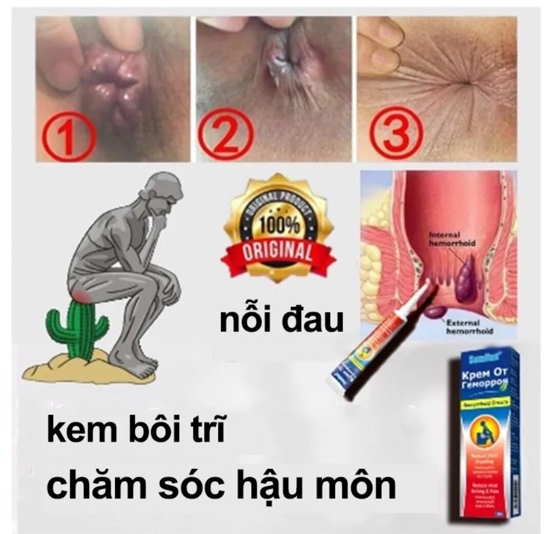 Kem bôi trĩ , hậu môn, kéo búi Trĩ.