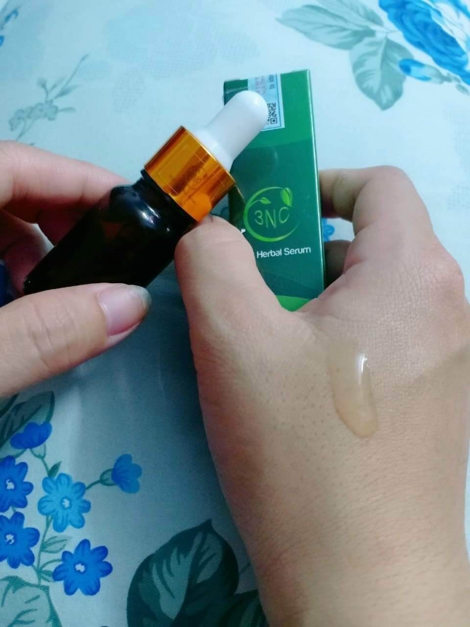 Serum ngừa mụn