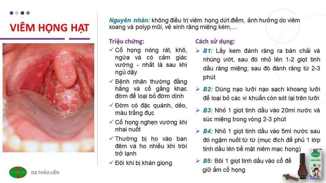 Tinh dầu răng miệng Dạ Thảo Liên