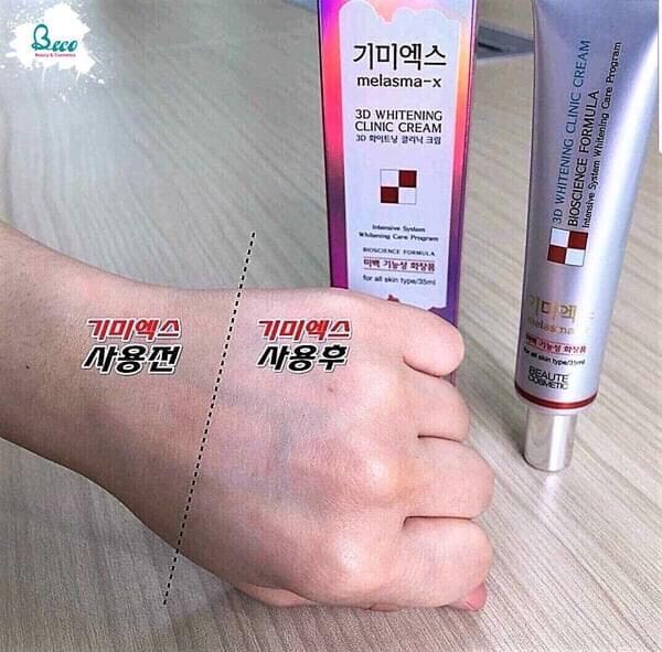 Kem Trị Nám 3D Whitenning Clinic Cream Melasma