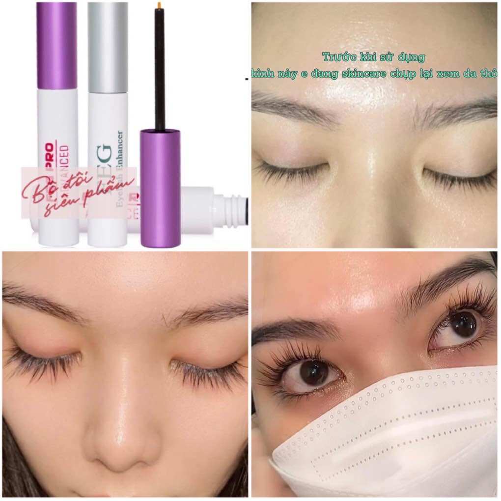 COMBO SERUM DÀI MI KÍCH MỌC MI DÀI VÀ DÀY