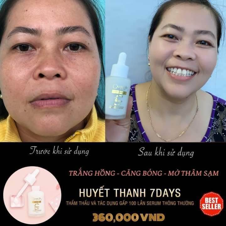 Huyết thanh 7day Queenie skin giúp căng bóng da mịn màng lọ 50,ml