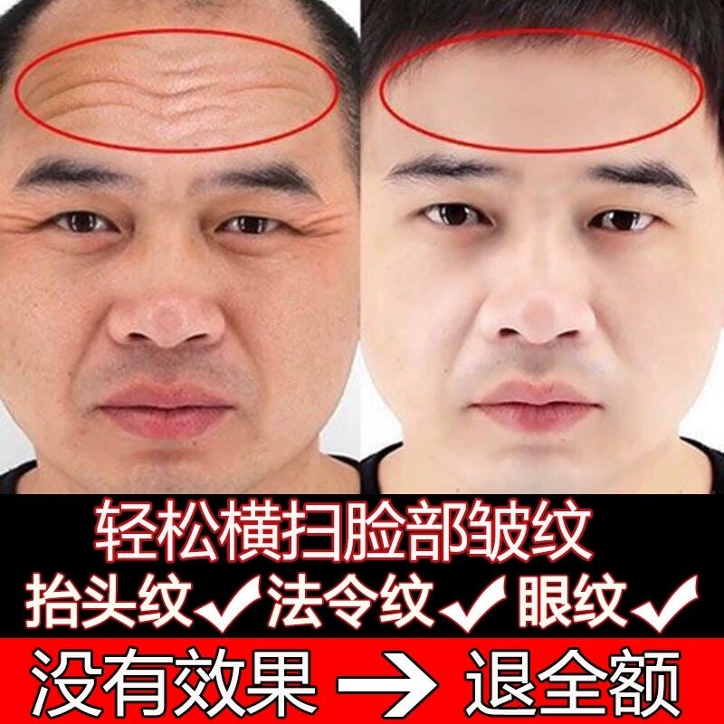 6 Chai Sáu Peptide Sáu Peptide Nước Chống Nhăn Kem Mặt Làm Mờ Nếp Nhăn Làm Săn Chắc Làm Mờ Nếp Nhăn Đầu Nam Nữ Lông Mi Hàn Quốc Bổ Sung Nước giá rẻ