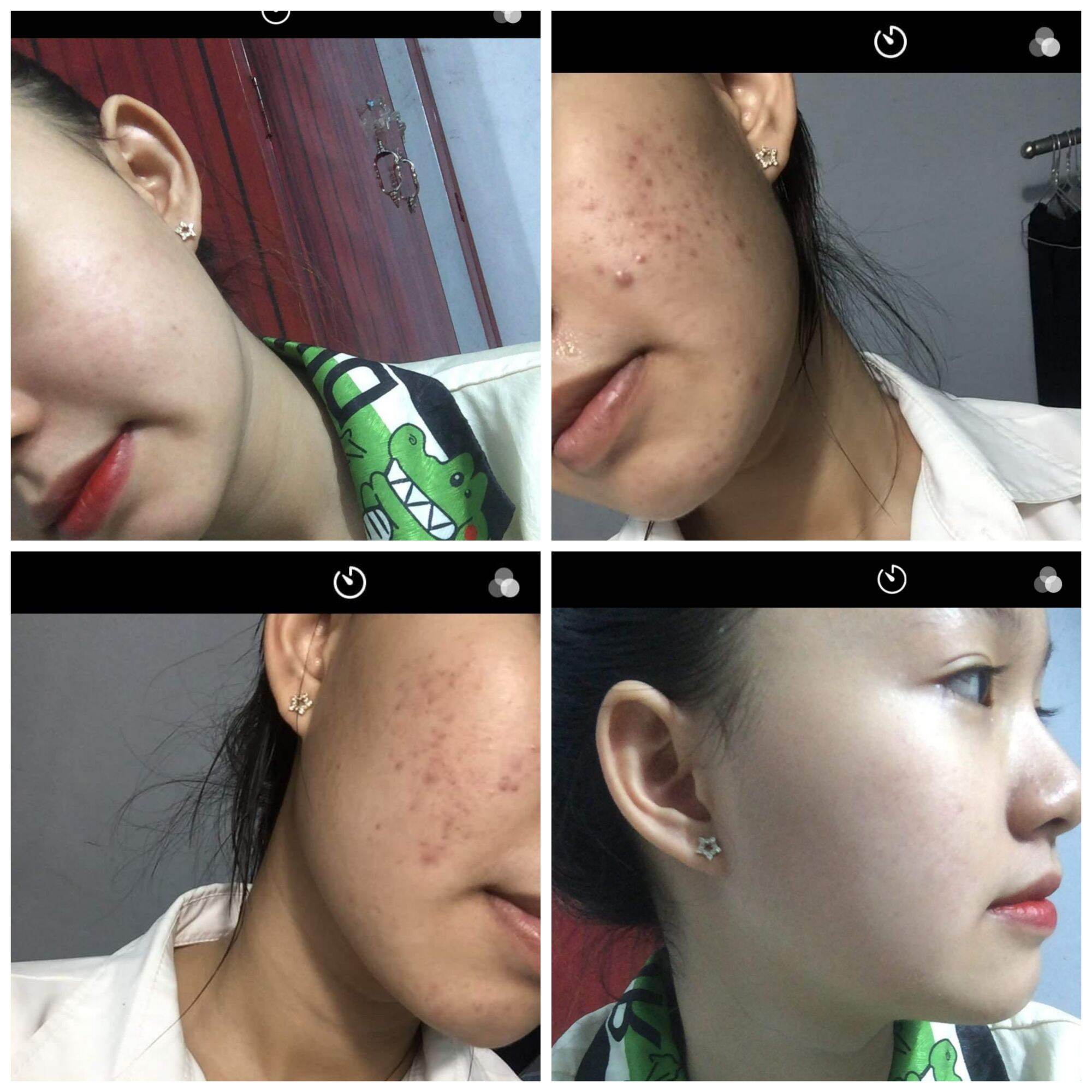 Đông y Sắc Ngọc Nữ tái tạo da